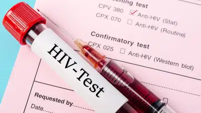 Sağlık Bakanlığı: Sosyal medyadaki HIV paylaşımları gerçeği yansıtmıyor